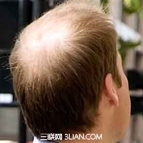 身体有这10个“缺陷”的人反而预示更健康