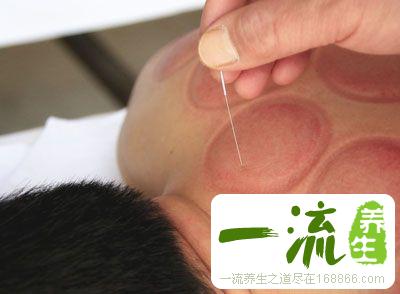 落枕了怎么办 7大简单方法快速有效治落枕