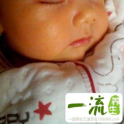 小儿黄疸 中医治疗黄疸有奇效