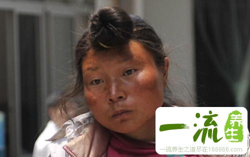 精神病的病因