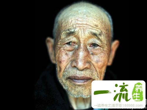 老年斑病因